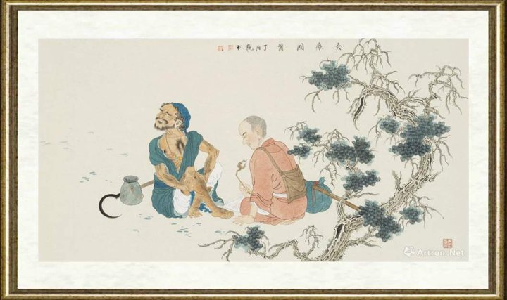 李巍松_灸疗图